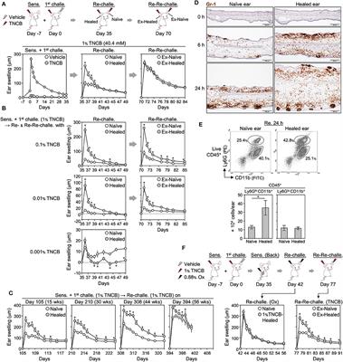 CD4+ Resident Memory T Cells Mediate Long-Term Local Skin Immune Memory of Contact Hypersensitivity in BALB/c Mice